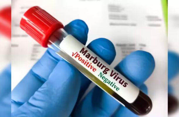GHS on high alert amid Marburg virus outbreak in Ethiopia