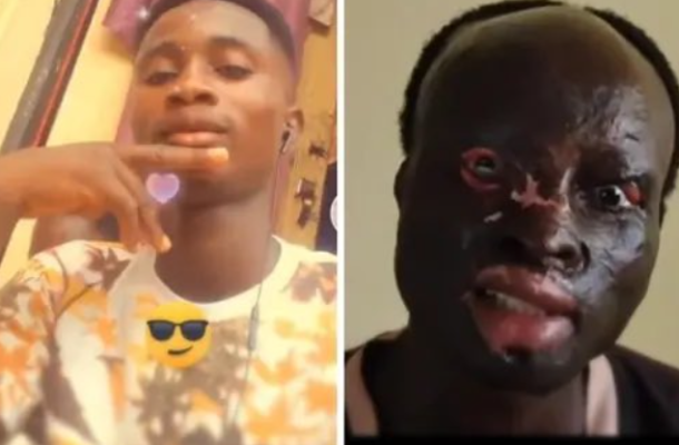 Houseboy jailed seven years for acid attack on SHS graduate in Ashanti Region