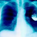 New pacemaker completely changes the functioning of a failing heart, Oxford scientists reveal