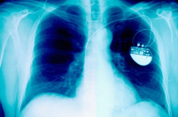 New pacemaker completely changes the functioning of a failing heart, Oxford scientists reveal