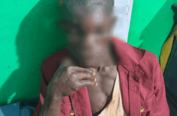 Man arrested for brutal scissors attack that left woman blinded in Sefwi Abrokofe