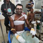 3 dead, 20 injured in Nsawam fuel siphoning tragedy — Police confirm