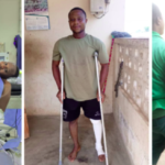 Brutal galamsey attack: - Forest guard battles for life