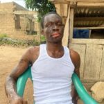 Aspiring journalist blinded in alleged acid attack appeals for help to restore sight