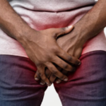Health officials raise alarm over rising genital warts cases in Ghana