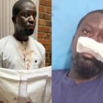 Ibrahim Mahama narrates how he was allegedly assaulted by Police