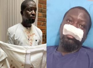 Ibrahim Mahama narrates how he was allegedly assaulted by Police