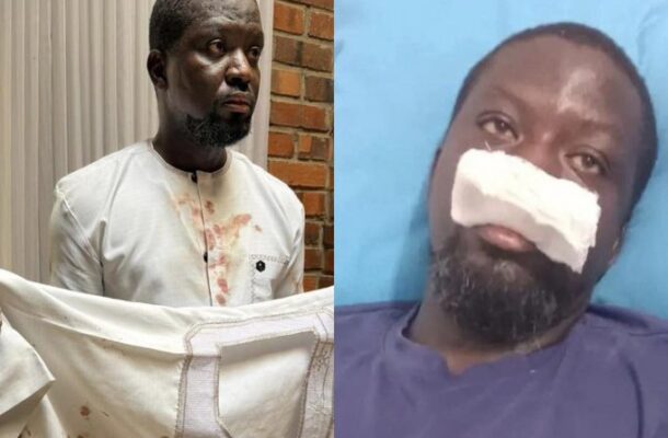 Ibrahim Mahama narrates how he was allegedly assaulted by Police