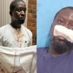 CID takes over probe into alleged assault on artist Ibrahim Mahama