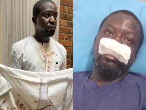 CID takes over probe into alleged assault on artist Ibrahim Mahama