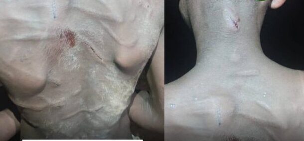 12-year-old girl allegedly beaten by mother over GHc10 plantain sale