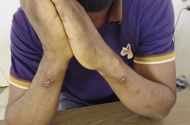 Retired police officer alleges brutal assault by National Security operatives in Ashanti Region